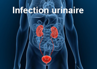markiertes urinsystem
